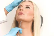 ChinFix: Kybella