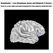 3-Dimensional Network Current Density for Assessment and/or Neurofeedback - [NGA] + [SURF1] + [SURF2]