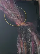 Fluid through Ring