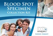 Vitamin D Test