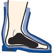Foam Narrowing Pads (1 Pair)
