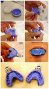 Mold Kit