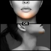 Chin Extension – Fall Sale