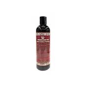 African Black Soap For Acne, Eczema & Psoriasis Body Wash