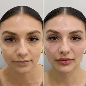 FaceFix: Liquid Face Lift