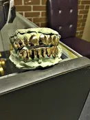 18k Gold Grill