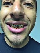 10k Yellow Gold Grill