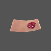 Gunshot Thigh Wound