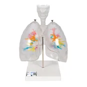 CT bronchial tree