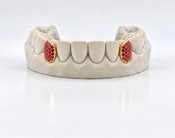 Custom Gemstone Grillz – Premium Gold with Ruby Gemstones DQ1041