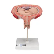 3B 5th Month Fetus Transverse Lie
