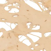Araña Blanco