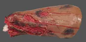 COMPLETE LEG AMPUTATION – RESCUE RANDY