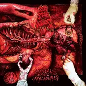 200 STAB WOUNDS – MANUAL MANIC PROCEDURES - CD •