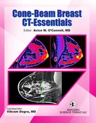 Cone-Beam Breast CT-Essentials - eBook