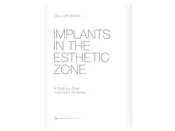 Implants in the Esthetic Zone: A Step-by-Step Treatment Strategy by Dr. Ueli Grunder