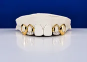Custom Open-Face with Diamond Slugs Grillz DQ1024