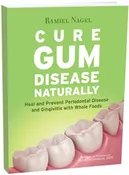 Cure Gum Disease Naturally