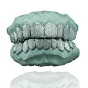 10K Gold - Dust Grillz