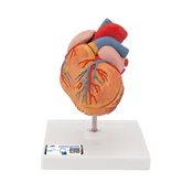 Classic Heart w. Left Ventric.