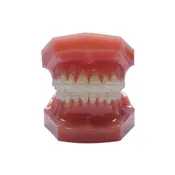 (10ct) Tooth Colored Stainless Steel (SS) Archwire, Natural
