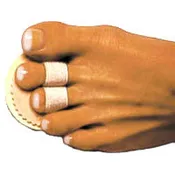 Budin Splint - Double Toe
