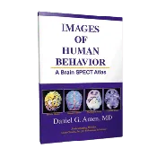 [Book] Images of Human Behavior - A Brain SPECT Atlas
