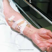 3M™ Durapore™ Surgical Tape