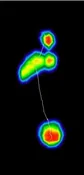 GAIT ANALISYS — Ideal Shoes