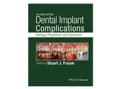 Dental Implant Complications: Etiology, Prevention, and Treatment, 2nd Edition