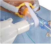 B & B Medical TrachStay™ Anti-Disconnect Device