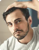 SMP Hairline Design