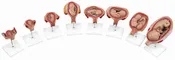 3B 4th Month Fetus Transverse Lie