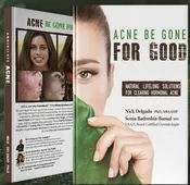 Acne Be Gone for Good – eBook