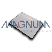 Carestream DRX-1 / DRX Revolution System Battery