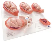 3B 5-Stage Birth Process Model