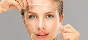 Chemical Peel
