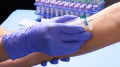 EasyPoint Blood Collection Tube Holder with Neede