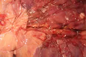 Chicken Livers