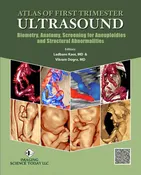Atlas of First Trimester Ultrasound