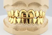 Dental Gold Grillz - NPG or 8K Gold Grillz