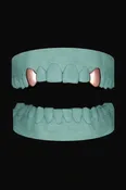 2 Teeth Grillz