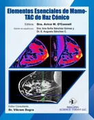 Cone-Beam Breast CT-Essentials - eBook Spanish