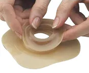 ADAPT CONVEX BARRIER RINGS 1-9/16", 40MM